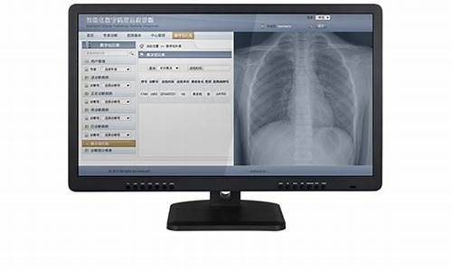 医用电脑系统价格多少_医院用的电脑系统